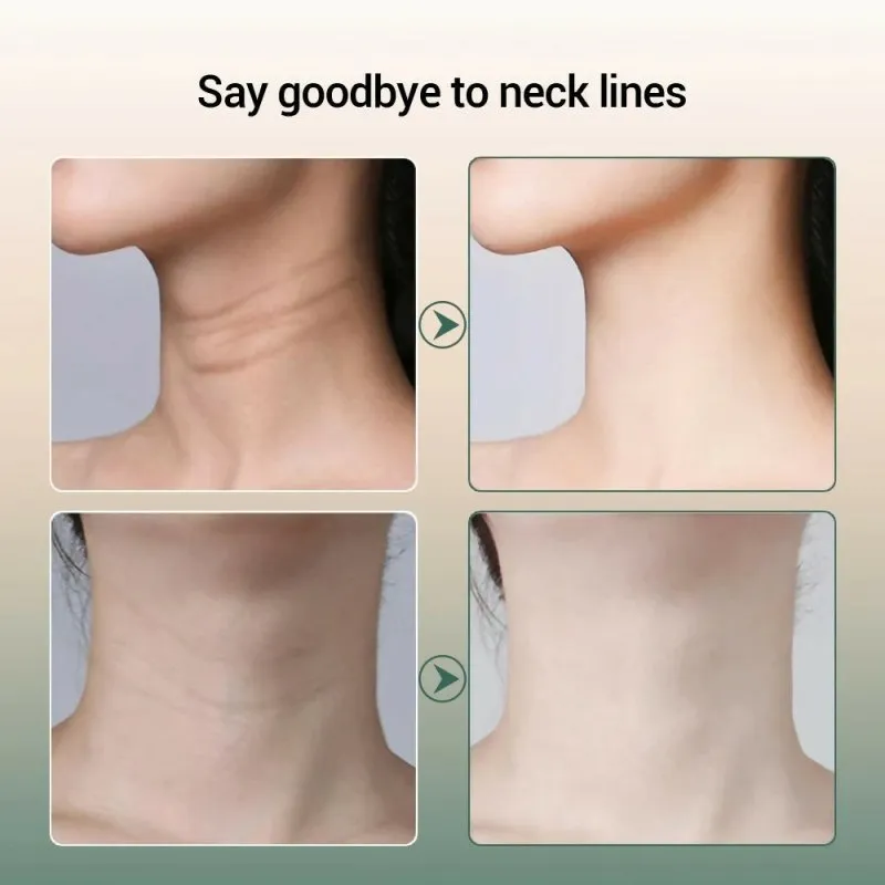 Constant Temperature Neck Beauty Instrument Facial Introduction Device (White)