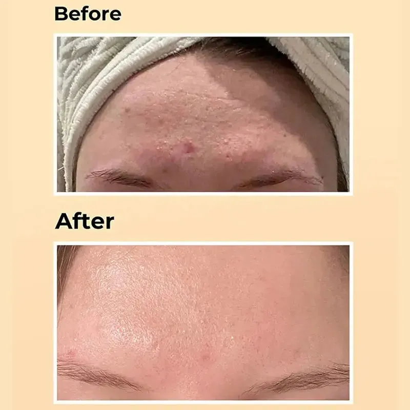 COSRX Snail Serum Essence Power Repairing Anti-aging
