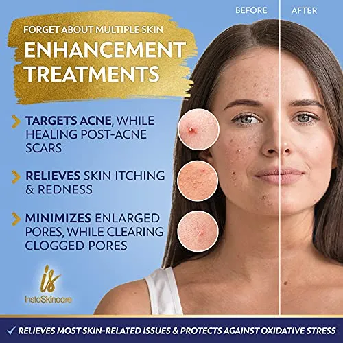 DOUBLE SIZED (2Oz) Niacinamide Serum for Face 10% with Zinc 1% Vitamin B3 Brightening Serum for for Tone, Texture and Hydrating