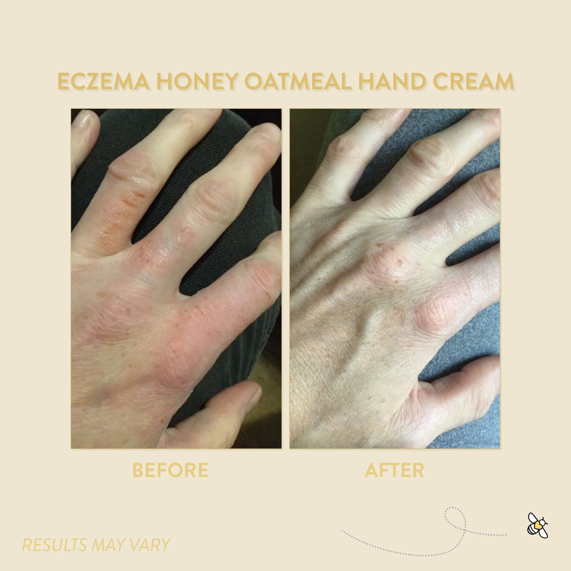 Eczema Honey Oatmeal Hand Cream 0.2 oz