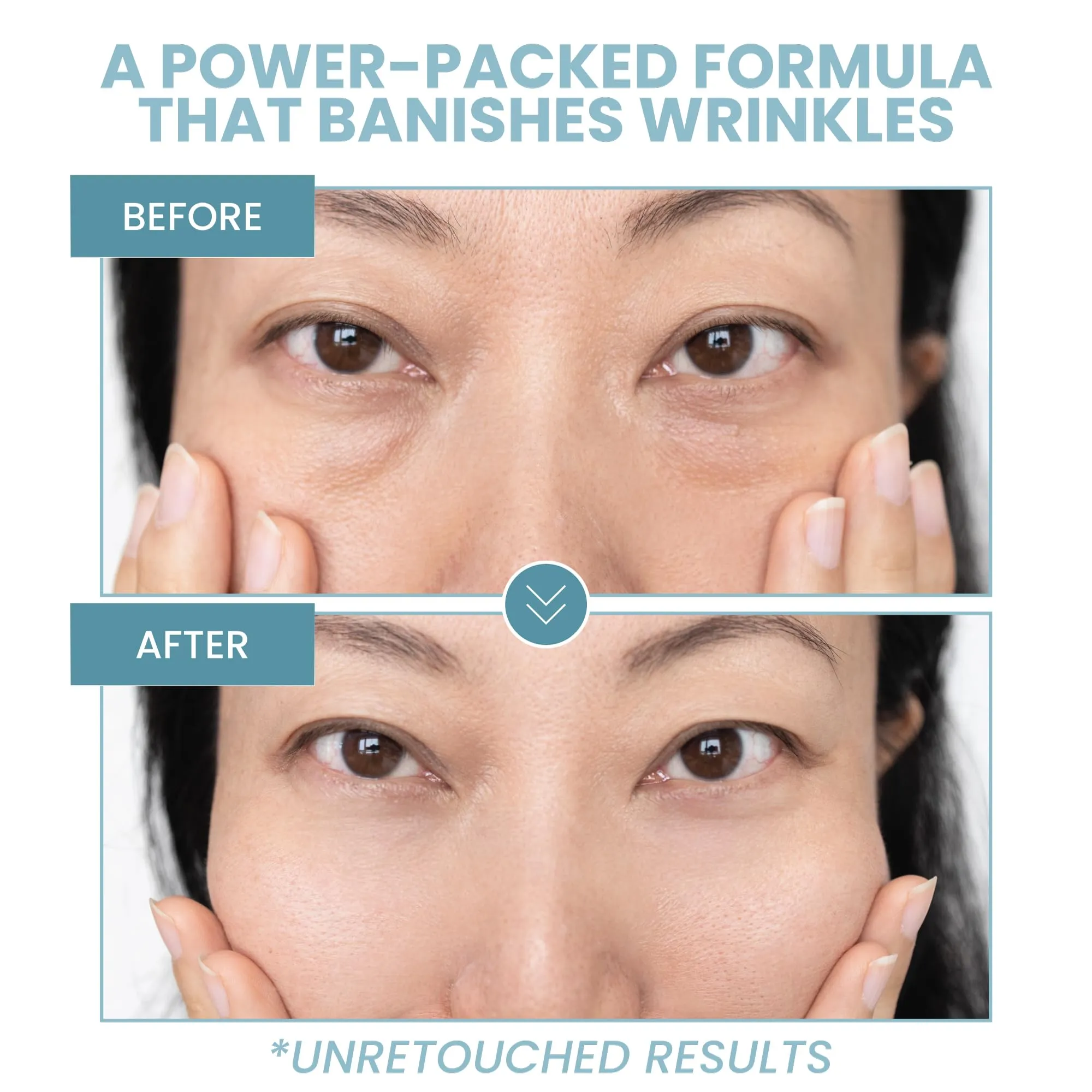 Eva Naturals Anti-Aging Eye Gel - Luxurious Hydrating Under Eye Cream For Dark Circles and Puffiness, Bags, Crows Feet, Wrinkles - With Hyaluronic Acid & Skin-Firming Peptides Eye Serum 2 oz (2 Pack)