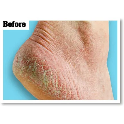 Healthy Feet foot cream for very dry, cracked feet, 85 g, O'Keeffe'S