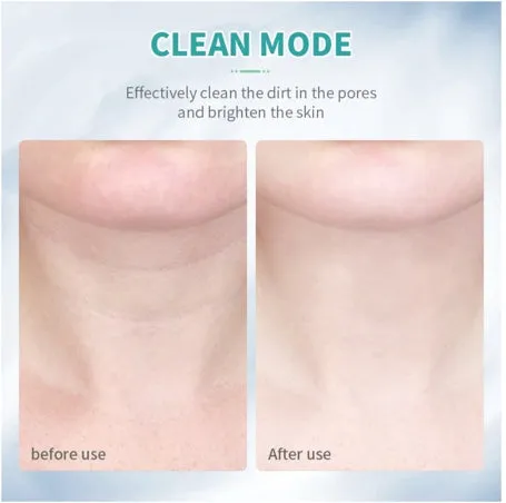 Neck Anti Wrinkle Face Lifting Beauty Device