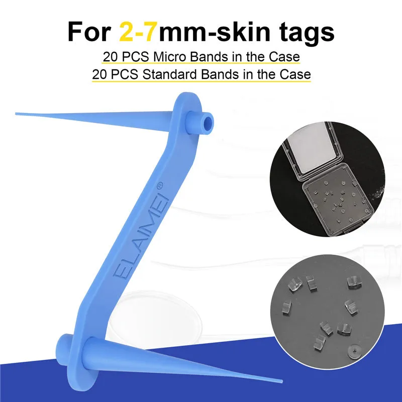 Wart or Skin Tag Remover Kit
