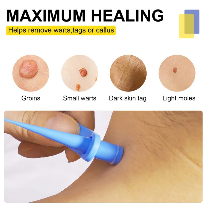 Wart or Skin Tag Remover Kit