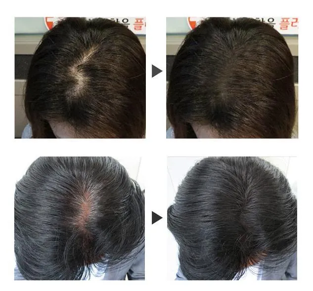 WENNIL Hair Nourishing Comb